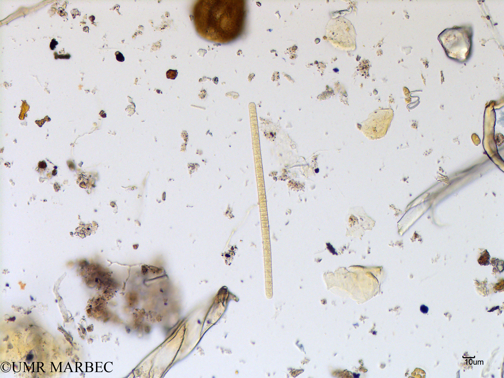 phyto/Scattered_Islands/mayotte_lagoon/SIREME May 2016/Trichodesmium sp4 (MAY2_trichodesmium).tif(copy).jpg
